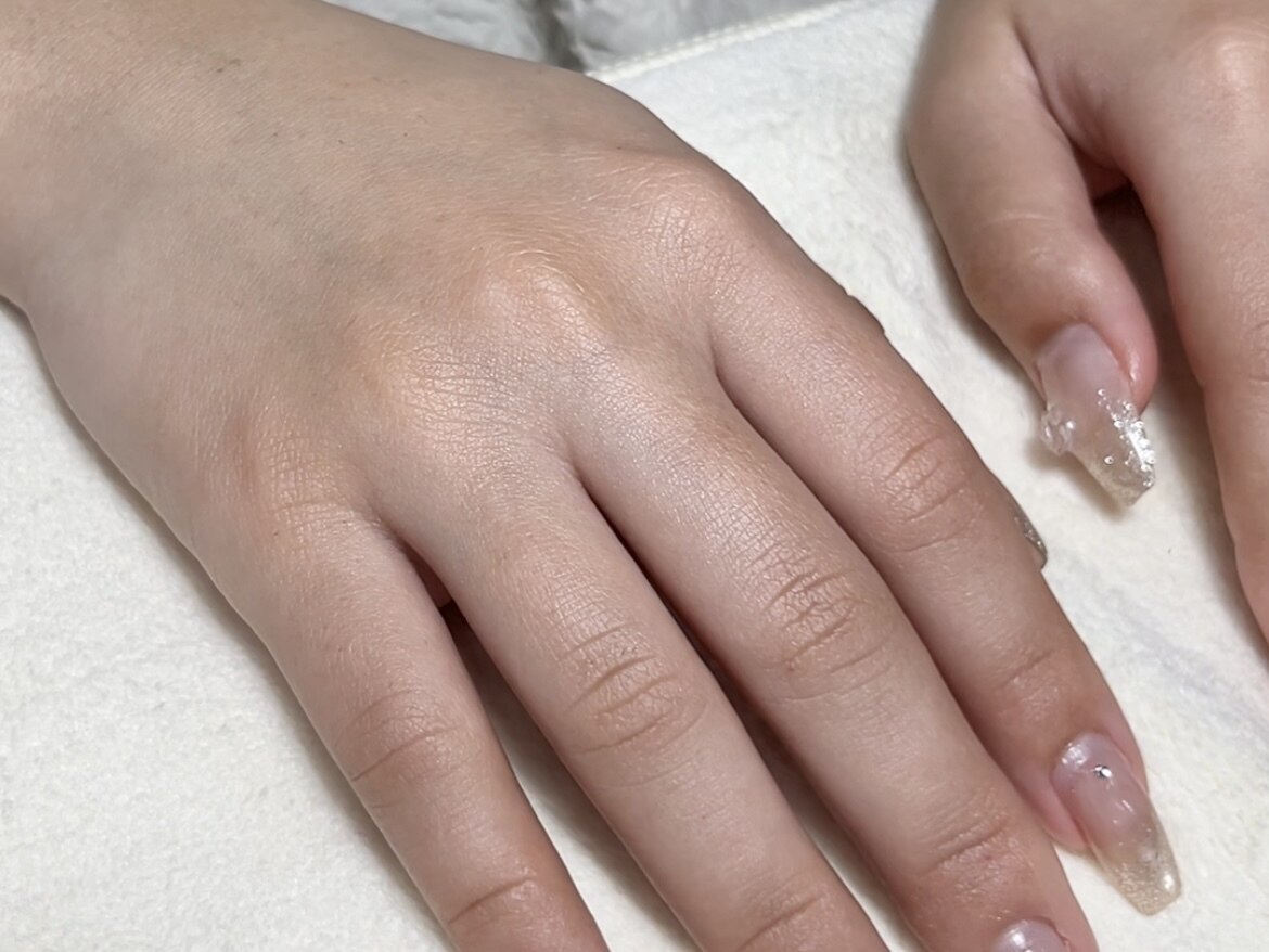 モデル様への施術